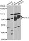 Acyl-CoA Synthetase Long Chain Family Member 5 antibody, LS-C335145, Lifespan Biosciences, Western Blot image 