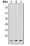 NADH:Ubiquinone Oxidoreductase Subunit V3 antibody, abx121533, Abbexa, Western Blot image 