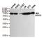 DEAD-Box Helicase 3 X-Linked antibody, GTX66840, GeneTex, Western Blot image 