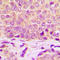 Heat Shock Protein Family B (Small) Member 1 antibody, LS-C358784, Lifespan Biosciences, Immunohistochemistry frozen image 