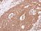 Adrenoceptor Beta 2 antibody, PA5-27083, Invitrogen Antibodies, Immunohistochemistry paraffin image 