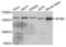 Splicing Factor 3b Subunit 2 antibody, LS-C334356, Lifespan Biosciences, Western Blot image 