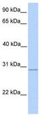 Polypeptide N-Acetylgalactosaminyltransferase 10 antibody, TA346785, Origene, Western Blot image 