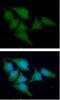 Cystatin A antibody, GTX57681, GeneTex, Immunocytochemistry image 