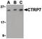 C1q And TNF Related 7 antibody, PA5-20156, Invitrogen Antibodies, Western Blot image 