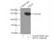 Serine/Threonine Kinase 36 antibody, 12559-1-AP, Proteintech Group, Immunoprecipitation image 