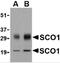 SCO Cytochrome C Oxidase Assembly Protein 1 antibody, 4043, ProSci, Western Blot image 