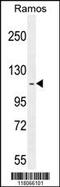 Huntingtin Interacting Protein 1 Related antibody, 55-634, ProSci, Western Blot image 