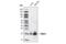 TIMP Metallopeptidase Inhibitor 3 antibody, 5673S, Cell Signaling Technology, Western Blot image 