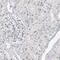 TSPY Like 1 antibody, HPA031971, Atlas Antibodies, Immunohistochemistry paraffin image 