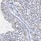Protein Interacting With Cyclin A1 antibody, NBP1-82698, Novus Biologicals, Immunohistochemistry frozen image 