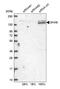 DEAH-Box Helicase 8 antibody, NBP2-13923, Novus Biologicals, Western Blot image 