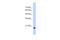 Heat Shock Protein Family B (Small) Member 6 antibody, ARP48436_T100, Aviva Systems Biology, Western Blot image 