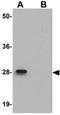 LIAR antibody, GTX85269, GeneTex, Western Blot image 