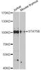 Signal Transducer And Activator Of Transcription 5B antibody, abx126664, Abbexa, Western Blot image 