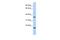 Potassium Calcium-Activated Channel Subfamily M Regulatory Beta Subunit 3 antibody, A09781, Boster Biological Technology, Western Blot image 