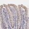 RNASEL antibody, NBP1-87230, Novus Biologicals, Immunohistochemistry paraffin image 