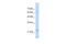 Troponin I1, Slow Skeletal Type antibody, 29-700, ProSci, Western Blot image 