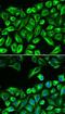 Hyaluronan Synthase 3 antibody, FNab03760, FineTest, Immunofluorescence image 