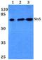 SIX Homeobox 5 antibody, PA5-75417, Invitrogen Antibodies, Western Blot image 