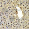 Deltex E3 Ubiquitin Ligase 2 antibody, A7398, ABclonal Technology, Immunohistochemistry paraffin image 
