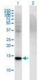 Retinol Binding Protein 7 antibody, MA5-24514, Invitrogen Antibodies, Western Blot image 