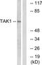 Mitogen-Activated Protein Kinase Kinase Kinase 7 antibody, LS-C117991, Lifespan Biosciences, Western Blot image 