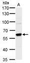Coactivator Associated Arginine Methyltransferase 1 antibody, GTX129040, GeneTex, Western Blot image 