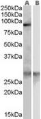 Scavenger Receptor Class F Member 1 antibody, TA302961, Origene, Western Blot image 