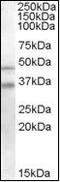 GULP PTB Domain Containing Engulfment Adaptor 1 antibody, orb88090, Biorbyt, Western Blot image 