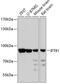 Intraflagellar Transport 81 antibody, 19-439, ProSci, Western Blot image 