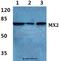 MX Dynamin Like GTPase 2 antibody, A02330-1, Boster Biological Technology, Western Blot image 