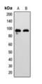EPH Receptor A7 antibody, orb393277, Biorbyt, Western Blot image 