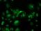 Aminoacylase 3 antibody, NBP2-03512, Novus Biologicals, Immunocytochemistry image 