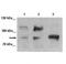 Forkhead Box M1 antibody, PA5-71455, Invitrogen Antibodies, Western Blot image 