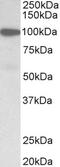 Gelsolin antibody, LS-C154994, Lifespan Biosciences, Western Blot image 