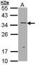 ERCC Excision Repair 1, Endonuclease Non-Catalytic Subunit antibody, GTX112848, GeneTex, Western Blot image 