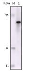 FES Proto-Oncogene, Tyrosine Kinase antibody, STJ98065, St John