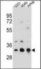 Tropomyosin 4 antibody, orb376216, Biorbyt, Western Blot image 