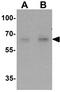 NMDA Receptor Synaptonuclear Signaling And Neuronal Migration Factor antibody, GTX31872, GeneTex, Western Blot image 