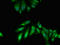 Twinfilin Actin Binding Protein 1 antibody, LS-C679930, Lifespan Biosciences, Immunofluorescence image 