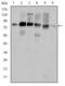 Cortactin antibody, STJ97963, St John