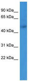 Adrenoceptor Alpha 1B antibody, TA342796, Origene, Western Blot image 