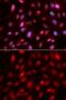 Small Ubiquitin Like Modifier 2 antibody, GTX54705, GeneTex, Immunofluorescence image 