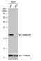 NME/NM23 Nucleoside Diphosphate Kinase 1 antibody, NBP2-19549, Novus Biologicals, Western Blot image 