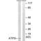 ATP Synthase Membrane Subunit E antibody, A12418, Boster Biological Technology, Western Blot image 