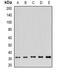 Fibroblast Growth Factor Binding Protein 1 antibody, abx225170, Abbexa, Western Blot image 