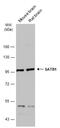 SATB Homeobox 1 antibody, GTX114737, GeneTex, Western Blot image 