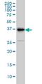 Tribbles Pseudokinase 3 antibody, H00057761-M08, Novus Biologicals, Western Blot image 