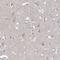 Rho GTPase-activating protein 44 antibody, HPA038814, Atlas Antibodies, Immunohistochemistry paraffin image 